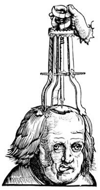 Trepanation from Hans von Gersdorff