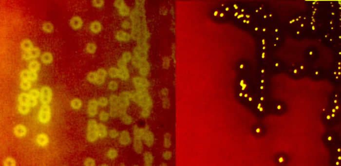 Alpha and Beta hemolytic streptococci grown on blood agar