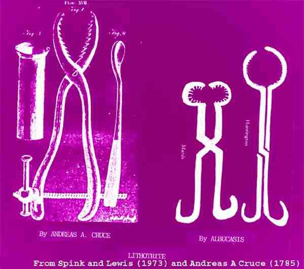 Andreas a Cruce's modification (left) of Al-Zahrawi's lithrocite (right): a composite diagram from Spink & Lewis and Andreas a Cruce