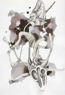 Ventricles Apart