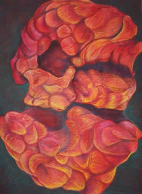 Cirrhosis
